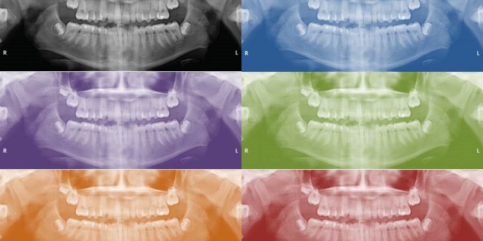 ORTOPANTODECOLORES