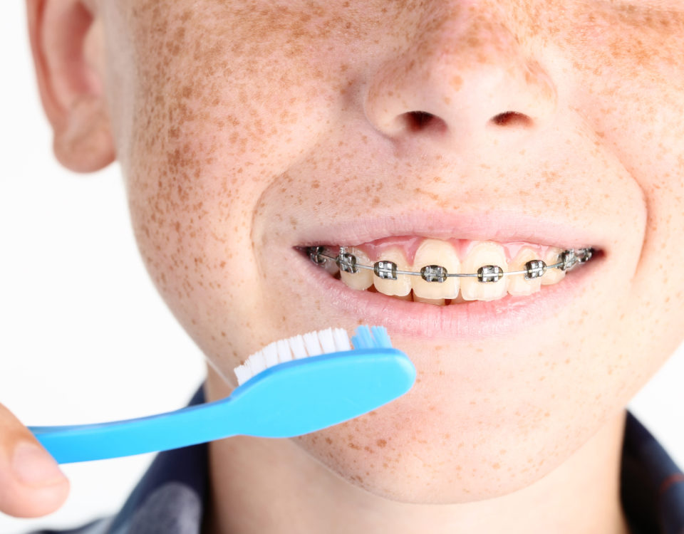 Young boy with dental braces and toothbrushes